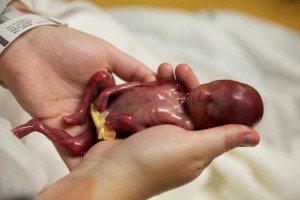 9191257555_7986ff478c_z