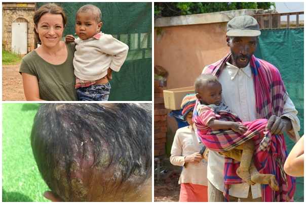 05 Ingrijire medicala si copil bolnav tuberculoza