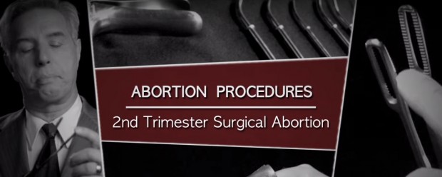 Un medic a făcut 1200 de avorturi. Acum dorește să arate lumii ce este de fapt un avort