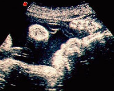 via breakingchristiannews.com