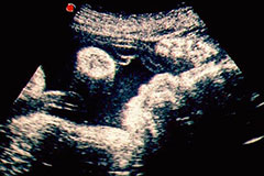 Tribunalul Suprem irlandez: Bebelușii nenăscuți au drepturi semnificative