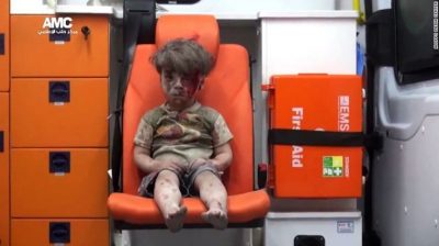 wounded-syrian-boy-in-aleppo
