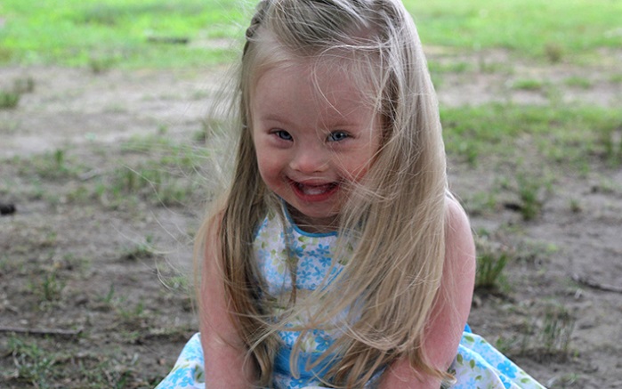 Danemarca își propune eradicarea totală a persoanelor cu sindromul Down